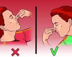 Xử trí nhanh khi bị chảy máu cam đột ngột